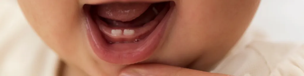 Bebek Ağız & Ter Bezi